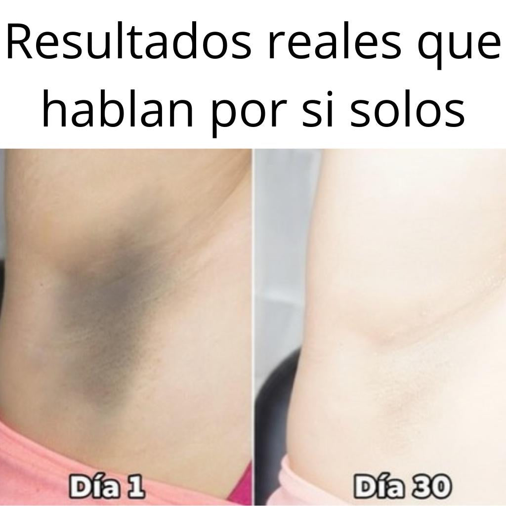 HudaBeauty: Tratamiento Blanqueador Unisex para manchas corporales, zonas íntimas, cuello, axilas, etc. Corrige e hidrata – 120 ml