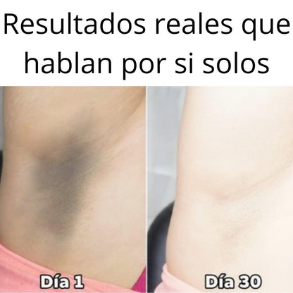 HudaBeauty: Tratamiento Blanqueador Unisex para manchas corporales, zonas íntimas, cuello, axilas, etc. Corrige e hidrata – 120 ml