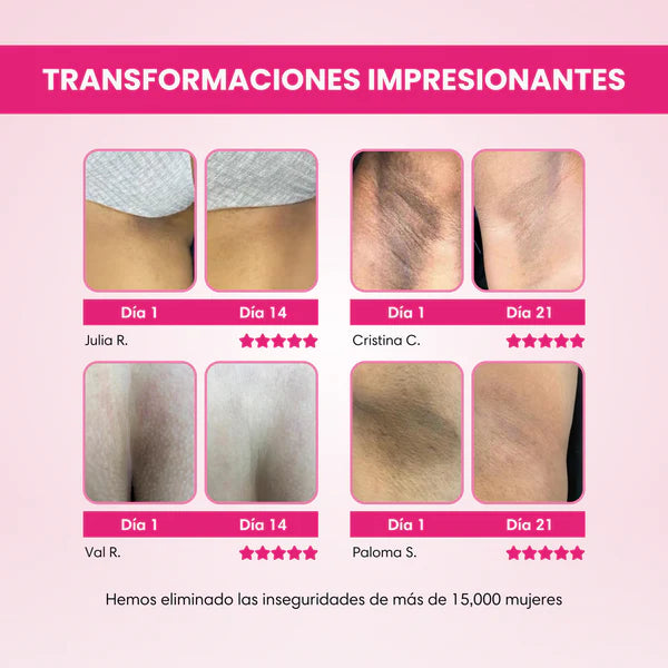 HudaBeauty: Tratamiento Blanqueador Unisex para manchas corporales, zonas íntimas, cuello, axilas, etc. Corrige e hidrata – 120 ml