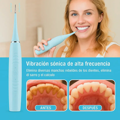 Limpiador Dental de Sarro Portátil - DentalClean Pro™